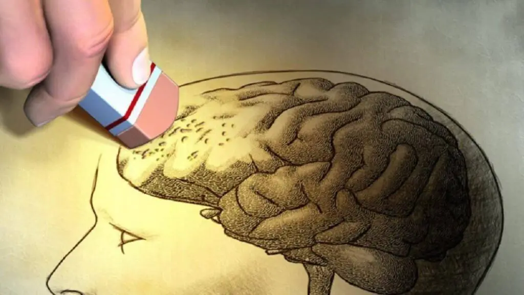 false memory syndrome